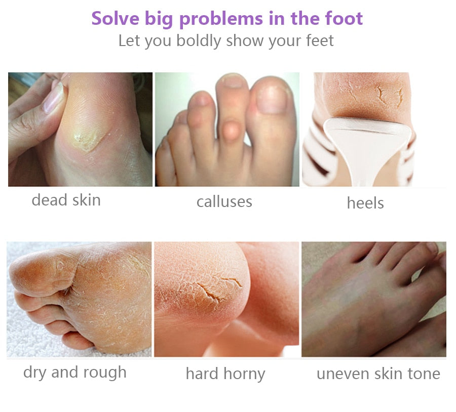 Avanile™ Foot Peeling Mask
