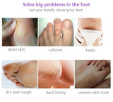 Avanile™ Foot Peeling Mask